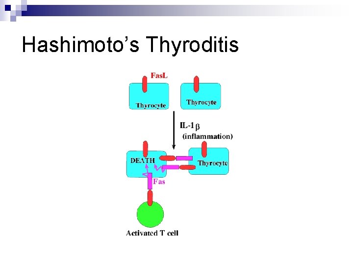 Hashimoto’s Thyroditis 