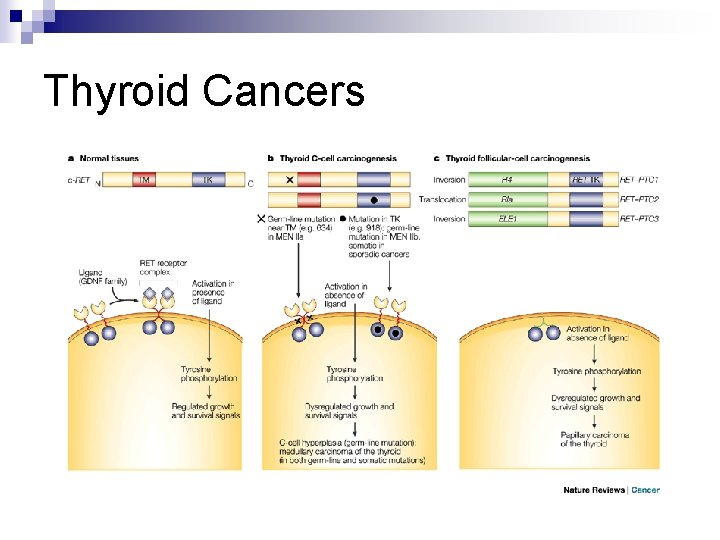 Thyroid Cancers 