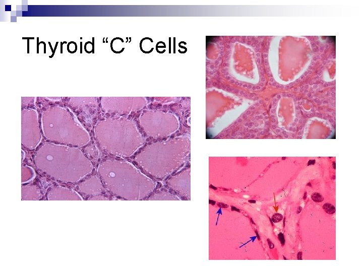 Thyroid “C” Cells 