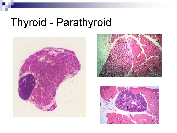 Thyroid - Parathyroid 