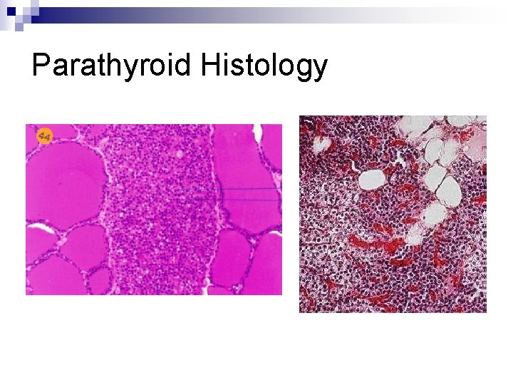 Parathyroid Histology 