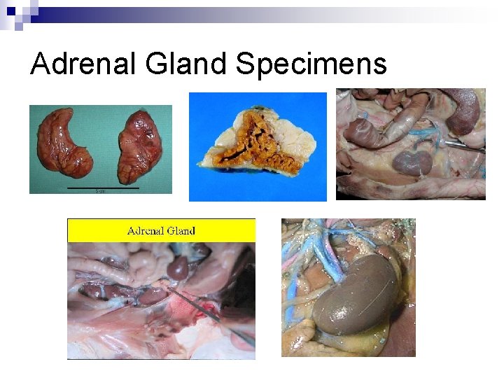 Adrenal Gland Specimens 