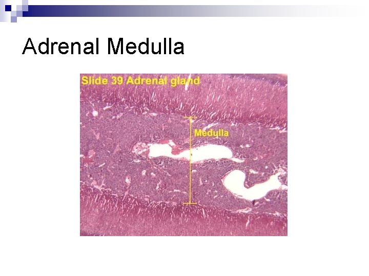 Adrenal Medulla 