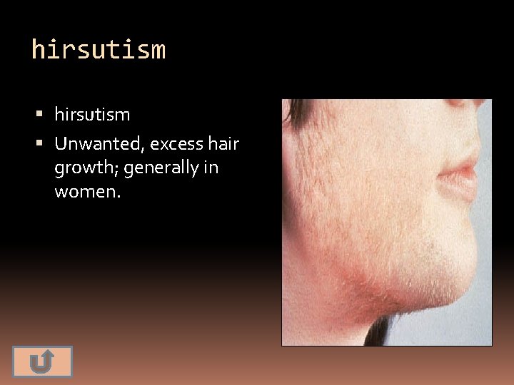 hirsutism Unwanted, excess hair growth; generally in women. 