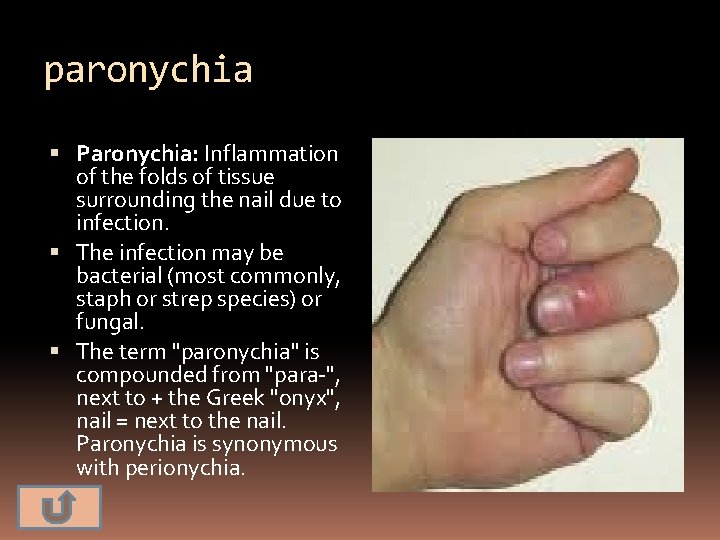 paronychia Paronychia: Inflammation of the folds of tissue surrounding the nail due to infection.