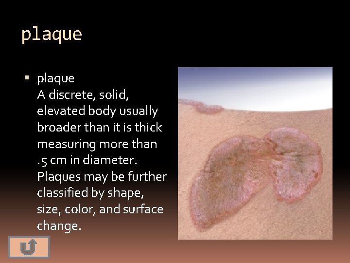 plaque A discrete, solid, elevated body usually broader than it is thick measuring more