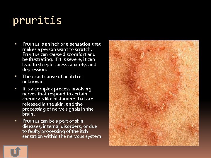 pruritis Pruritus is an itch or a sensation that makes a person want to