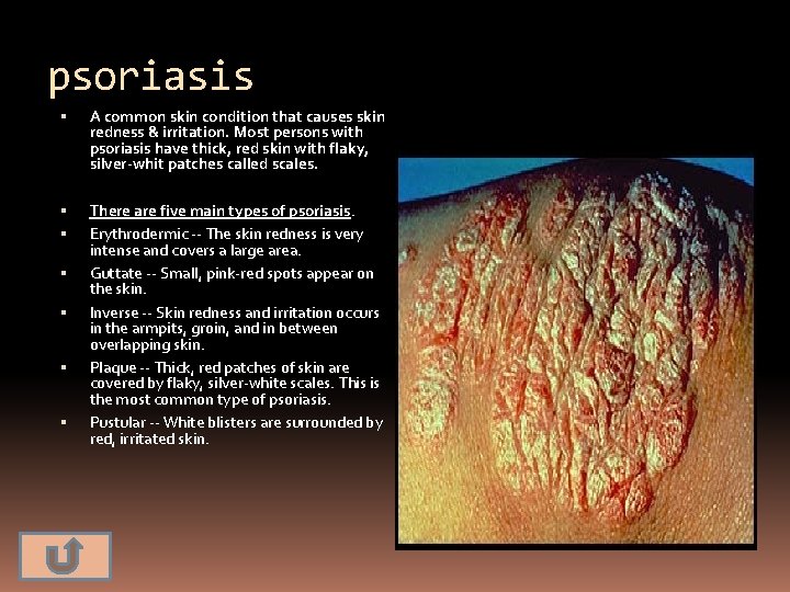 psoriasis A common skin condition that causes skin redness & irritation. Most persons with