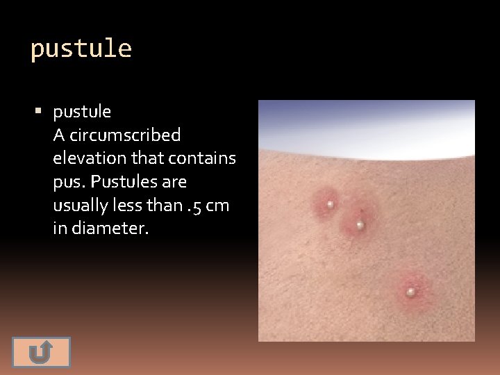 pustule A circumscribed elevation that contains pus. Pustules are usually less than. 5 cm