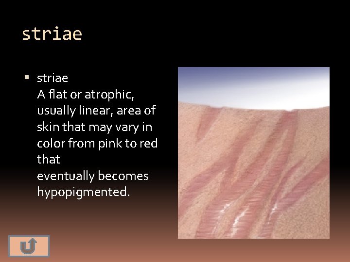 striae A flat or atrophic, usually linear, area of skin that may vary in