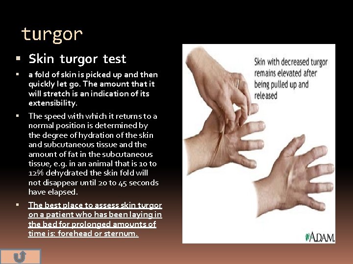 turgor Skin turgor test a fold of skin is picked up and then quickly