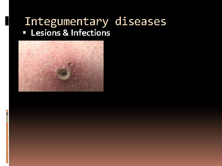 Integumentary diseases Lesions & Infections 