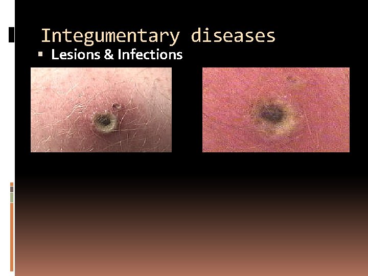 Integumentary diseases Lesions & Infections 