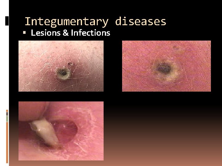 Integumentary diseases Lesions & Infections 