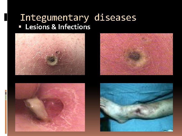 Integumentary diseases Lesions & Infections 