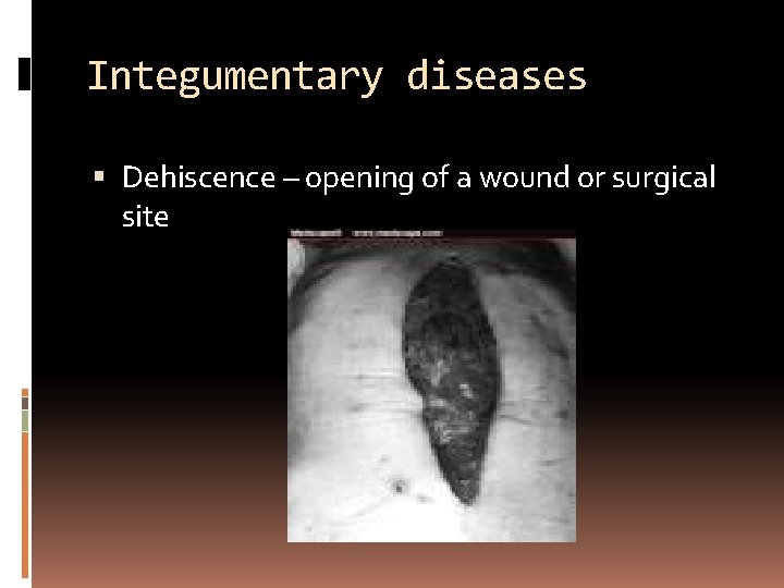 Integumentary diseases Dehiscence – opening of a wound or surgical site 