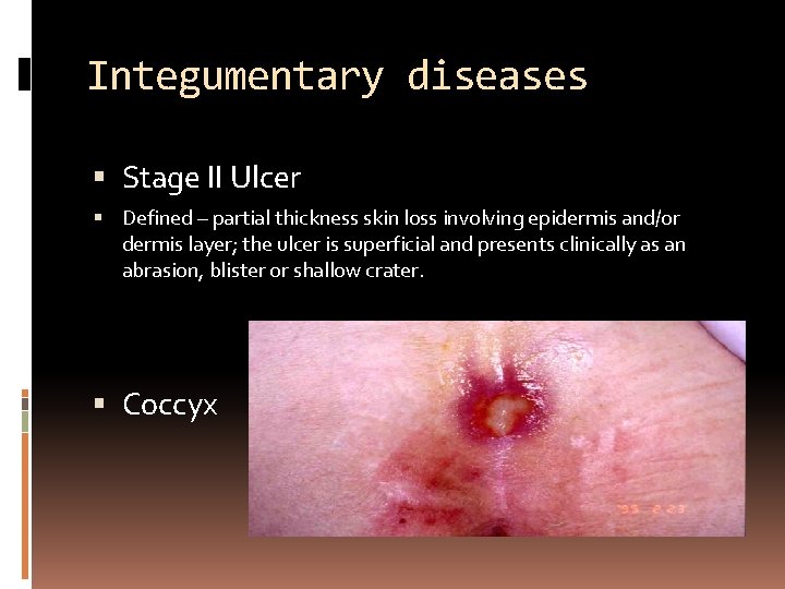 Integumentary diseases Stage II Ulcer Defined – partial thickness skin loss involving epidermis and/or