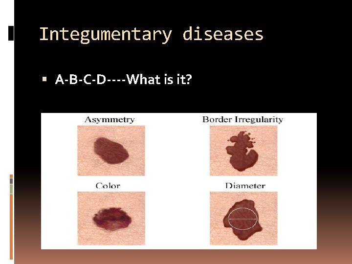 Integumentary diseases A-B-C-D----What is it? 