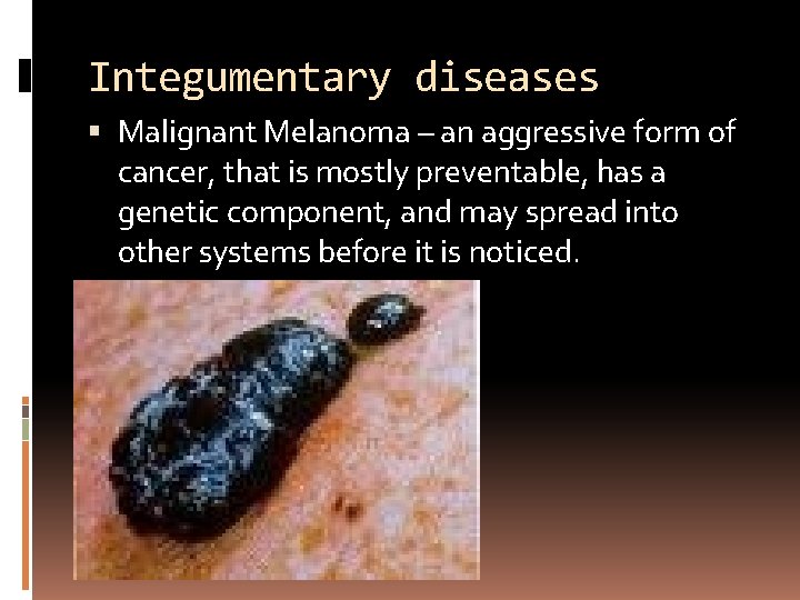 Integumentary diseases Malignant Melanoma – an aggressive form of cancer, that is mostly preventable,