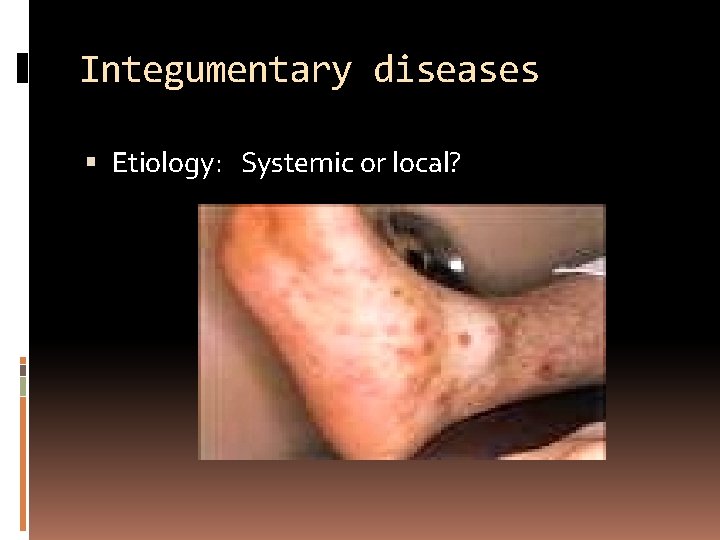 Integumentary diseases Etiology: Systemic or local? 