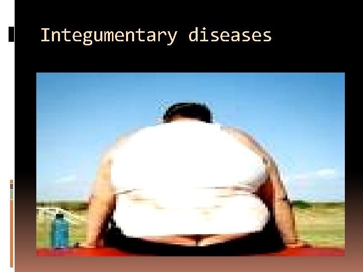 Integumentary diseases 