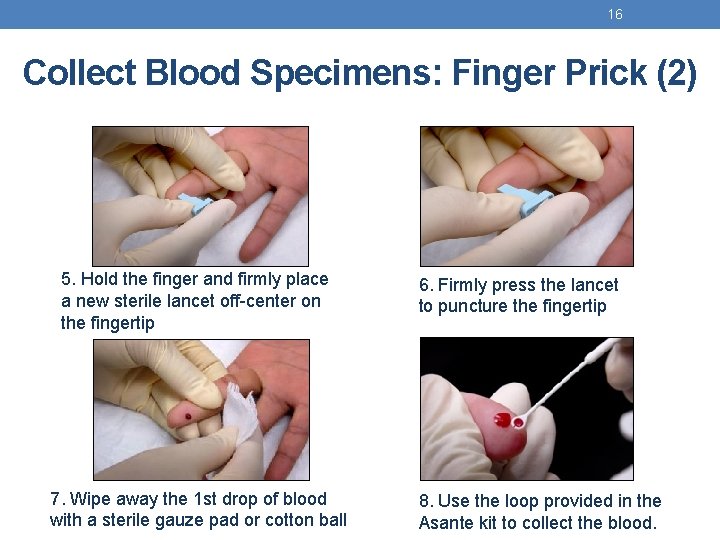 16 Collect Blood Specimens: Finger Prick (2) 5. Hold the finger and firmly place