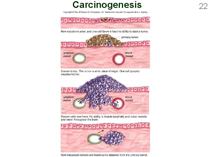 Carcinogenesis 22 