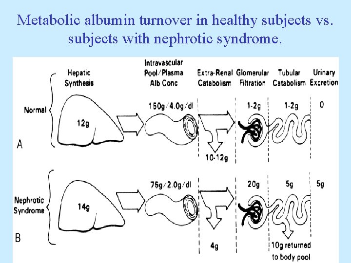 Metabolic albumin turnover in healthy subjects vs. subjects with nephrotic syndrome. 