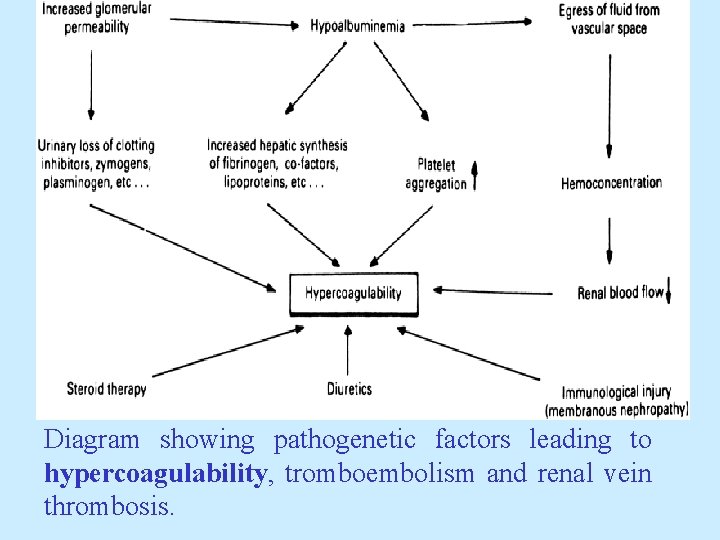Diagram showing pathogenetic factors leading to hypercoagulability, tromboembolism and renal vein thrombosis. 