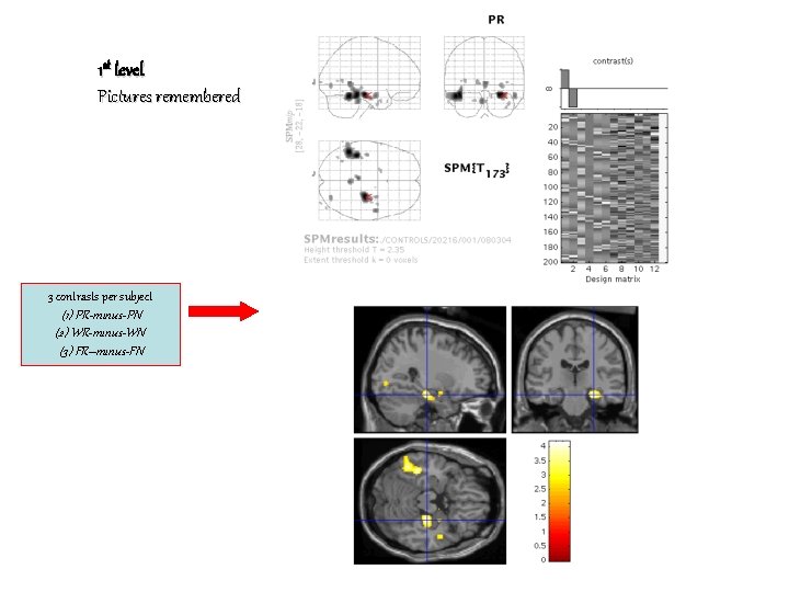 1 st level Pictures remembered 3 contrasts per subject (1) PR-minus-PN (2) WR-minus-WN (3)