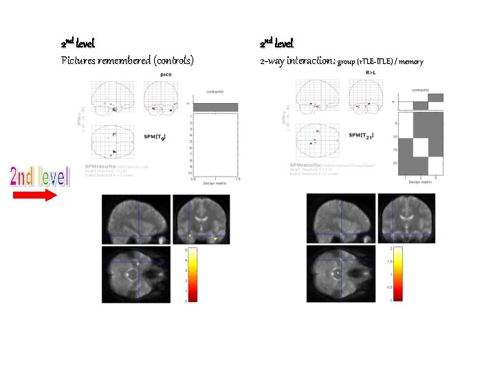 2 nd level Pictures remembered (controls) 2 nd level 2 -way interaction: group (r.