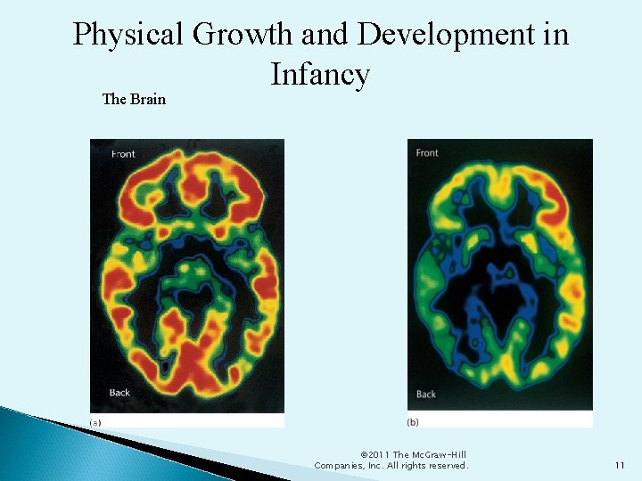 Physical Growth and Development in Infancy The Brain © 2011 The Mc. Graw-Hill Companies, Physical Growth and Development in Infancy The Brain © 2011 The Mc. Graw-Hill Companies,