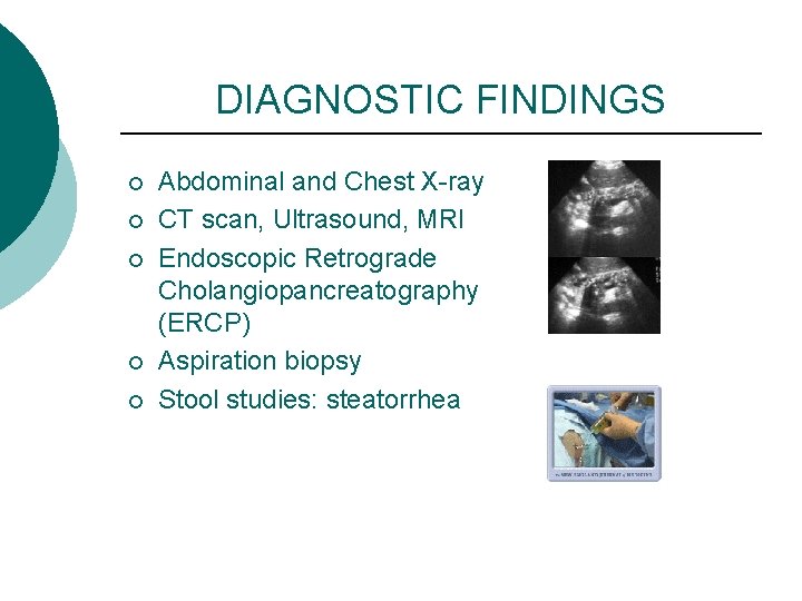 DIAGNOSTIC FINDINGS ¡ ¡ ¡ Abdominal and Chest X-ray CT scan, Ultrasound, MRI Endoscopic