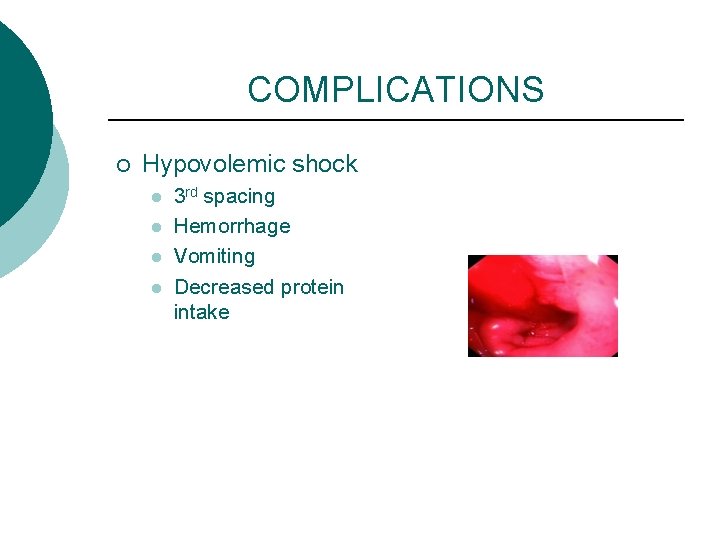 COMPLICATIONS ¡ Hypovolemic shock l l 3 rd spacing Hemorrhage Vomiting Decreased protein intake