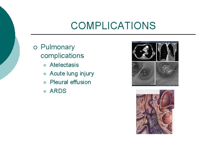 COMPLICATIONS ¡ Pulmonary complications l l Atelectasis Acute lung injury Pleural effusion ARDS 