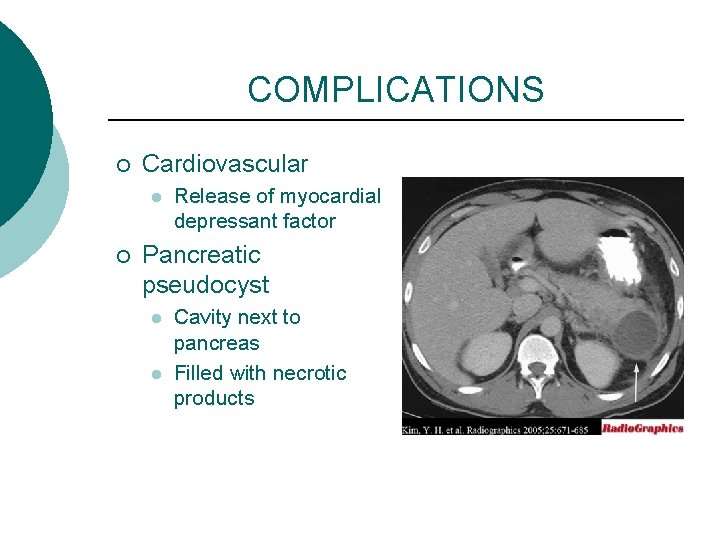 COMPLICATIONS ¡ Cardiovascular l ¡ Release of myocardial depressant factor Pancreatic pseudocyst l l