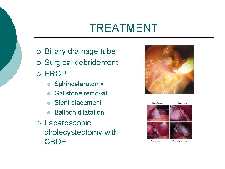 TREATMENT ¡ ¡ ¡ Biliary drainage tube Surgical debridement ERCP l l ¡ Sphinceterotomy