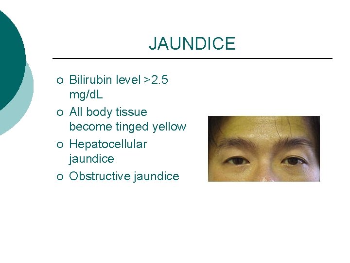 JAUNDICE ¡ ¡ Bilirubin level >2. 5 mg/d. L All body tissue become tinged
