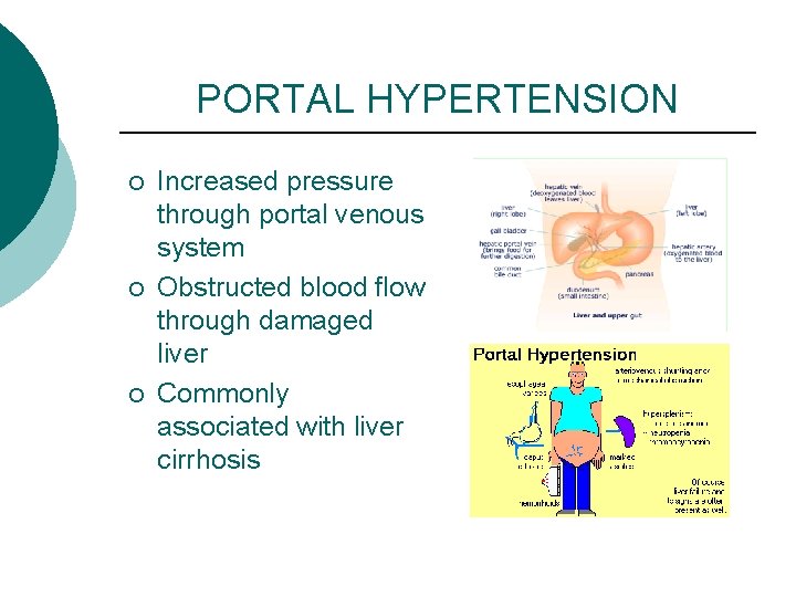 PORTAL HYPERTENSION ¡ ¡ ¡ Increased pressure through portal venous system Obstructed blood flow