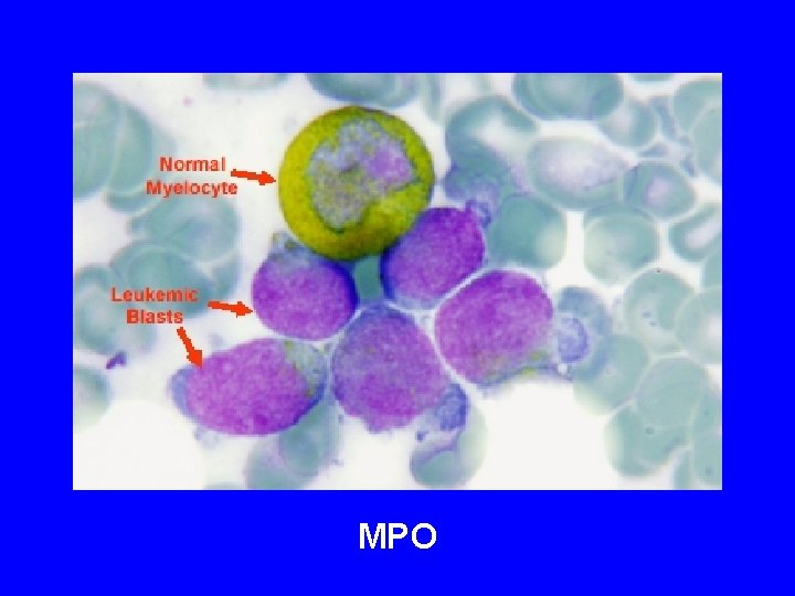 MPO MPO