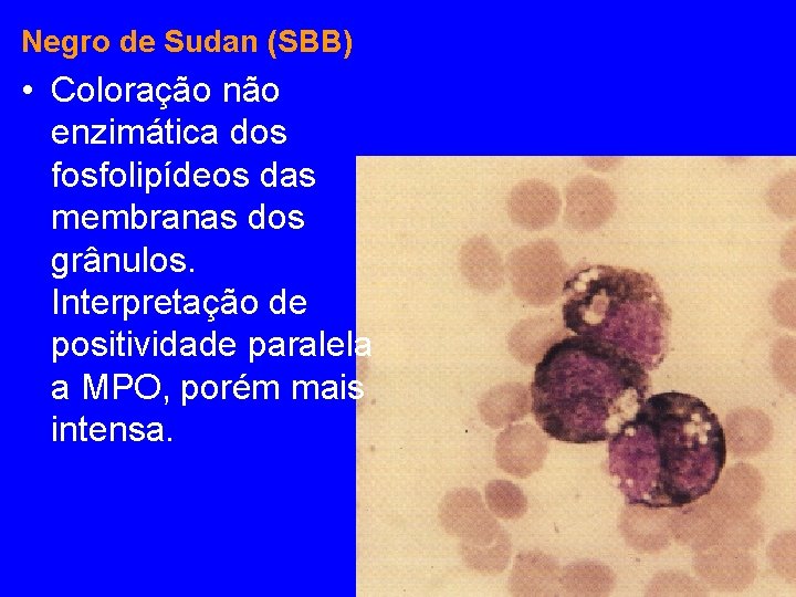 Negro de Sudan (SBB) • Coloração não enzimática dos fosfolipídeos das membranas dos grânulos. Negro de Sudan (SBB) • Coloração não enzimática dos fosfolipídeos das membranas dos grânulos.