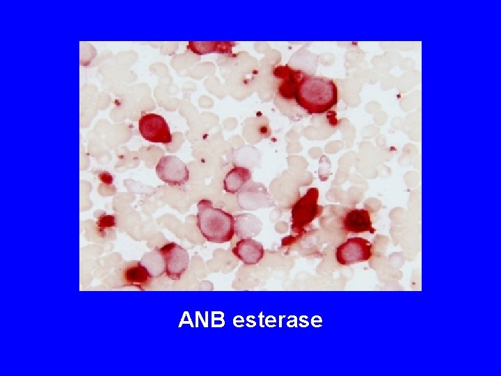 ANB esterase ANB esterase