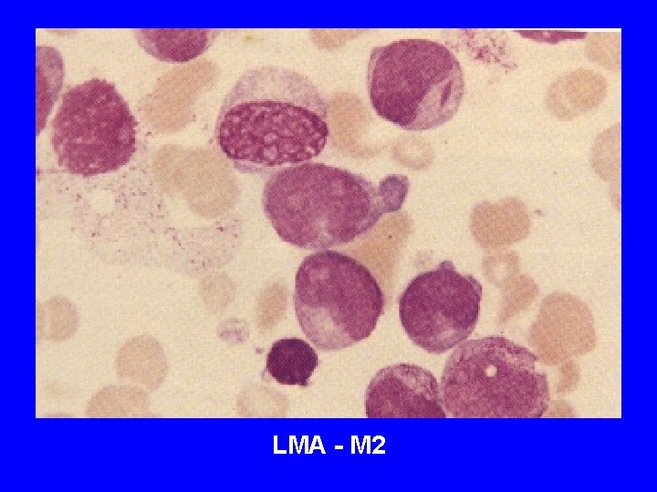 LMA - M 2 LMA - M 2
