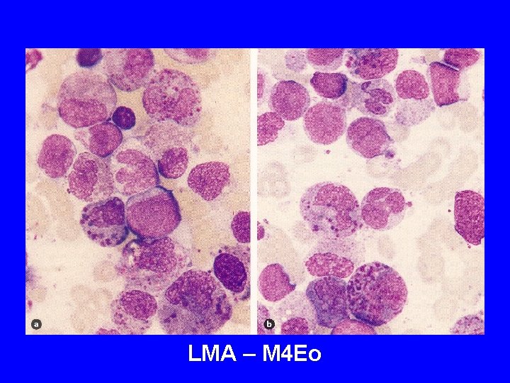 LMA – M 4 Eo LMA – M 4 Eo