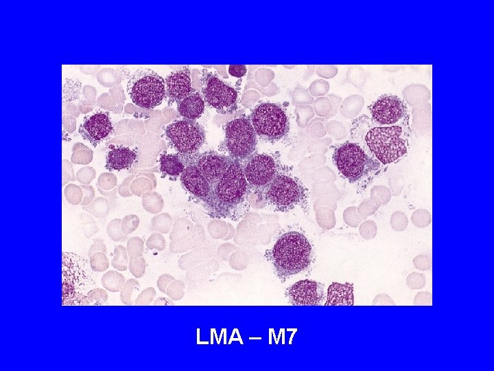 LMA – M 7 LMA – M 7