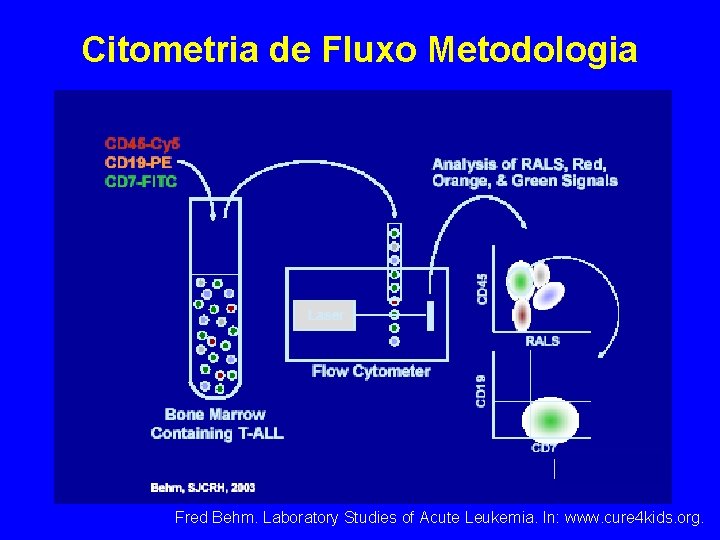 Citometria de Fluxo Metodologia Fred Behm. Laboratory Studies of Acute Leukemia. In: www. cure Citometria de Fluxo Metodologia Fred Behm. Laboratory Studies of Acute Leukemia. In: www. cure