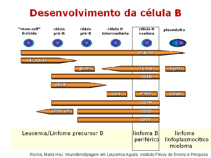 Rocha, Maria Hsu. Imunofenotipagem em Leucemia Aguda. Instituto Fleury de Ensino e Pesquisa. Rocha, Maria Hsu. Imunofenotipagem em Leucemia Aguda. Instituto Fleury de Ensino e Pesquisa.