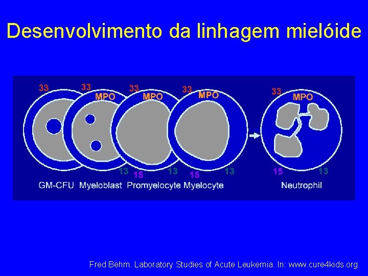 Desenvolvimento da linhagem mielóide Fred Behm. Laboratory Studies of Acute Leukemia. In: www. cure Desenvolvimento da linhagem mielóide Fred Behm. Laboratory Studies of Acute Leukemia. In: www. cure