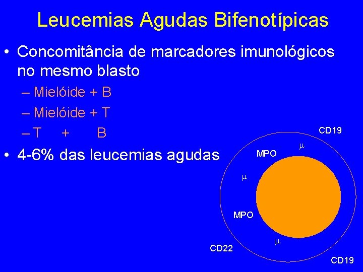 Leucemias Agudas Bifenotípicas • Concomitância de marcadores imunológicos no mesmo blasto – Mielóide + Leucemias Agudas Bifenotípicas • Concomitância de marcadores imunológicos no mesmo blasto – Mielóide +