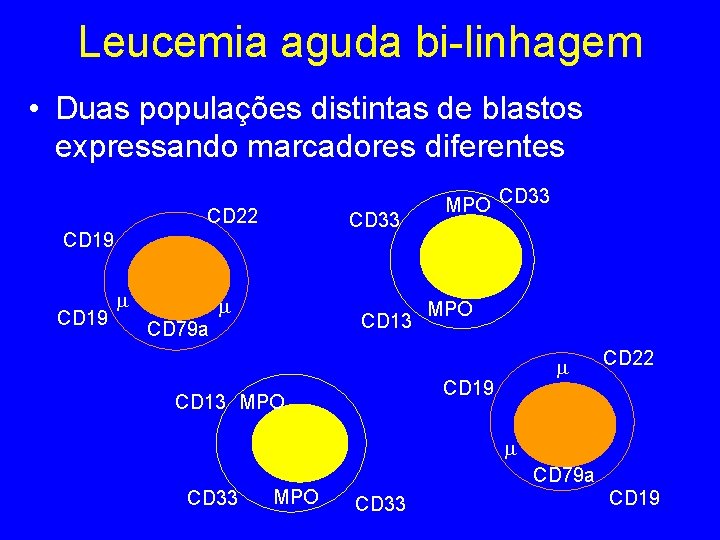 Leucemia aguda bi-linhagem • Duas populações distintas de blastos expressando marcadores diferentes CD 22 Leucemia aguda bi-linhagem • Duas populações distintas de blastos expressando marcadores diferentes CD 22